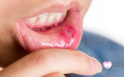 Bump and  Sores in The Roof of The Mouth