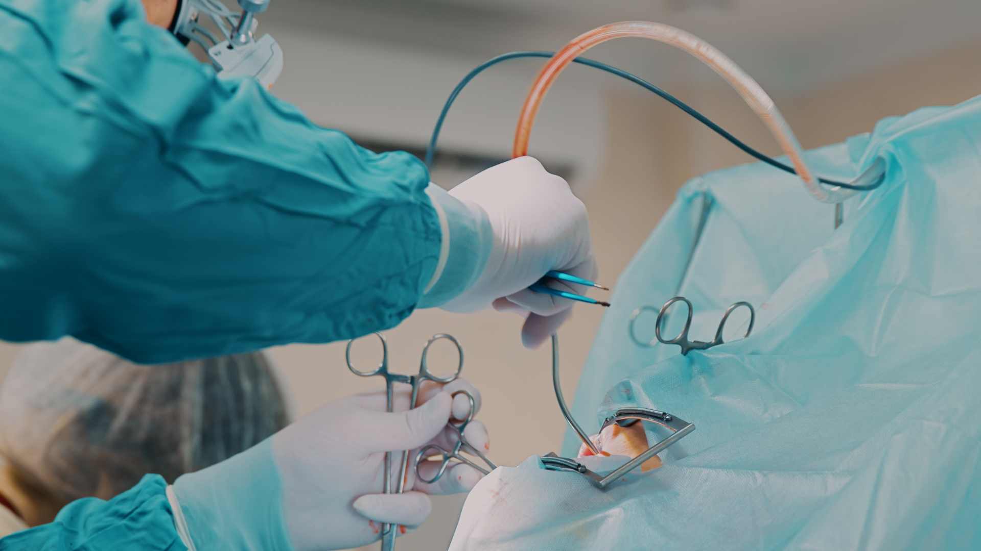 What Types of Oral Surgery and Benefits Brazos Smiles